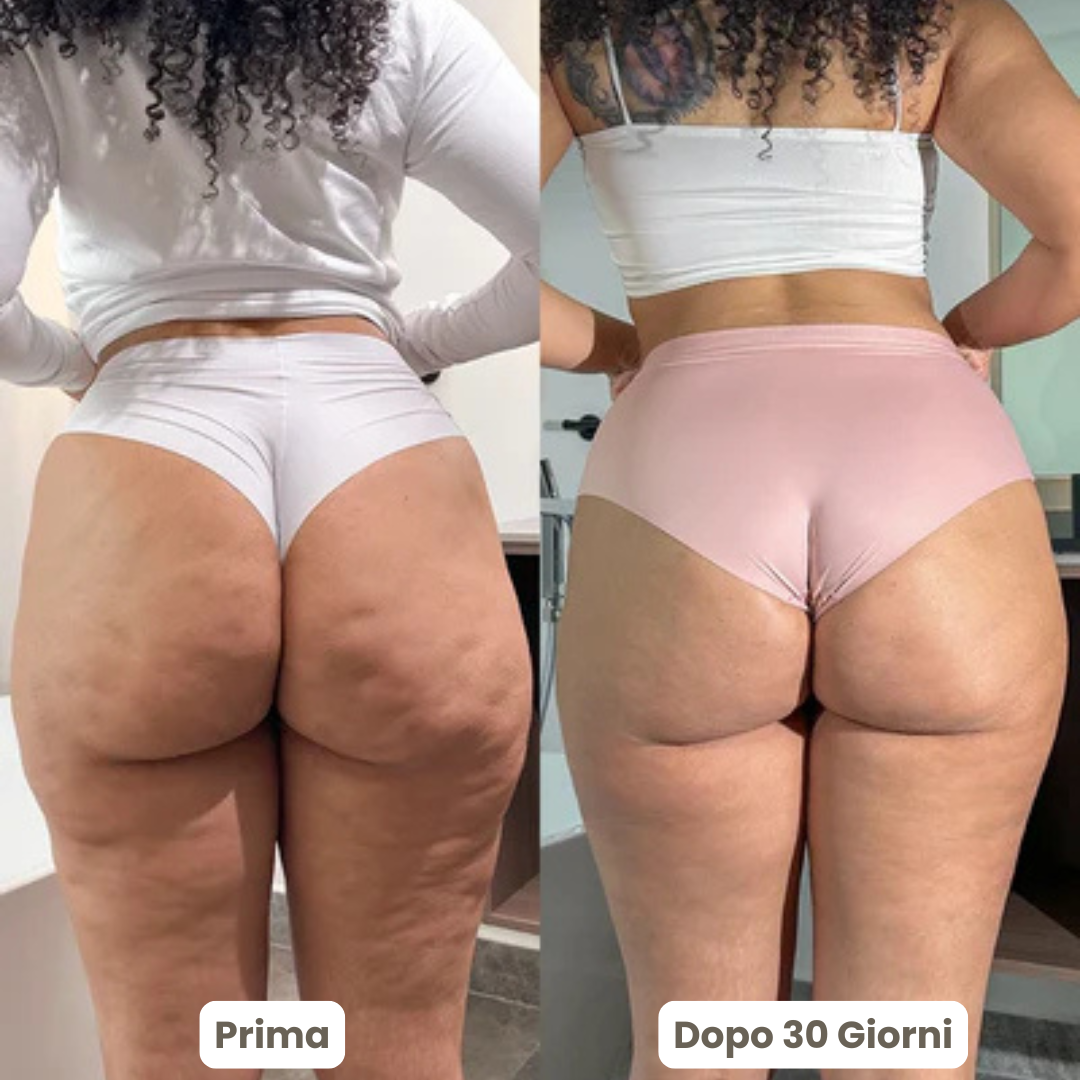 ReduSculpt™ - Appareil Remodelant Corps 3 en 1