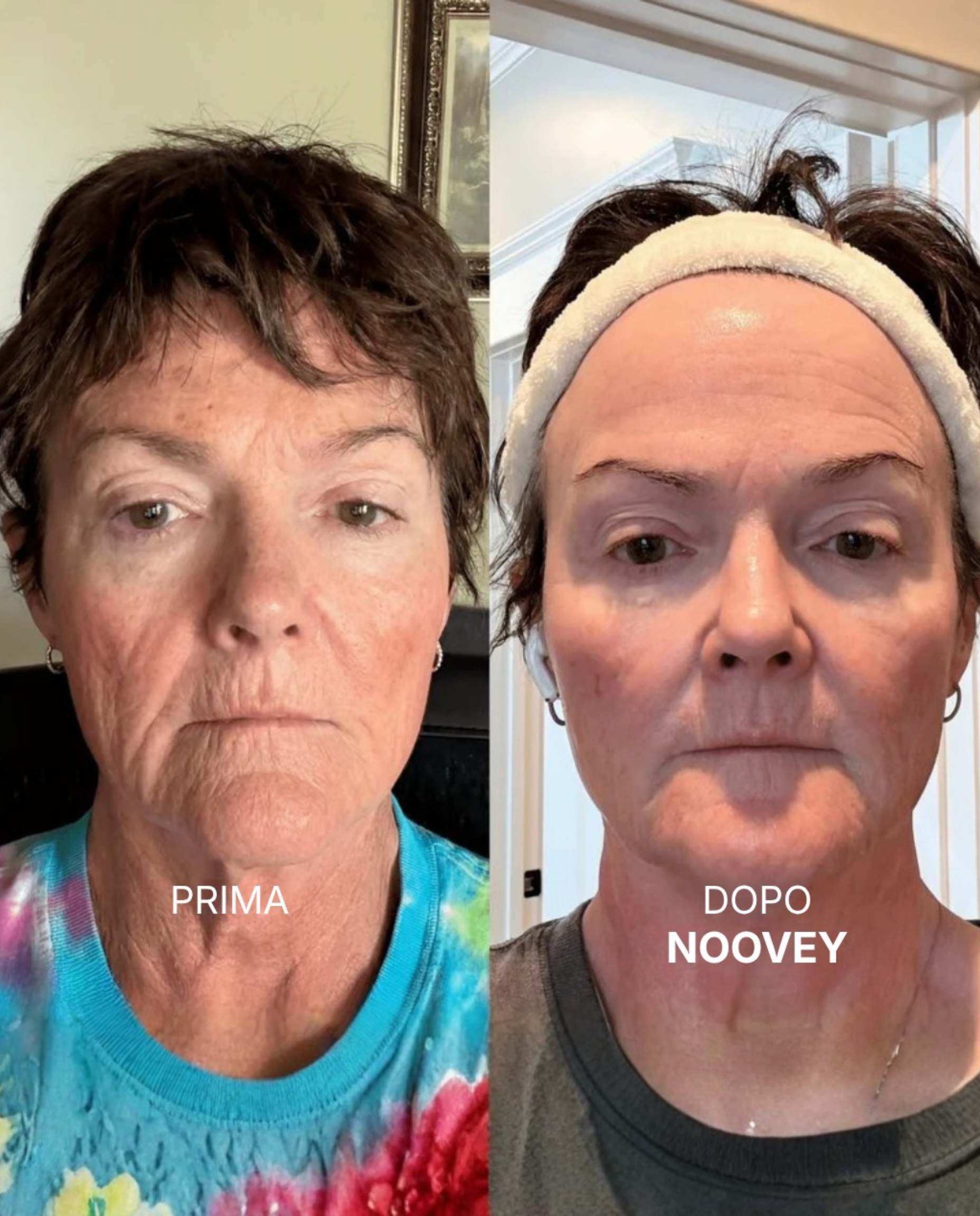 Kollagen-Lifting-Balsam-Stick - Formel mit NAD+ & PDRN