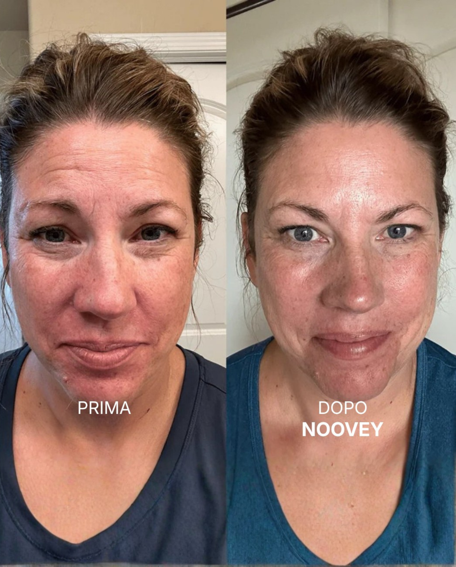 Kollagen-Lifting-Balsam-Stick - Formel mit NAD+ & PDRN