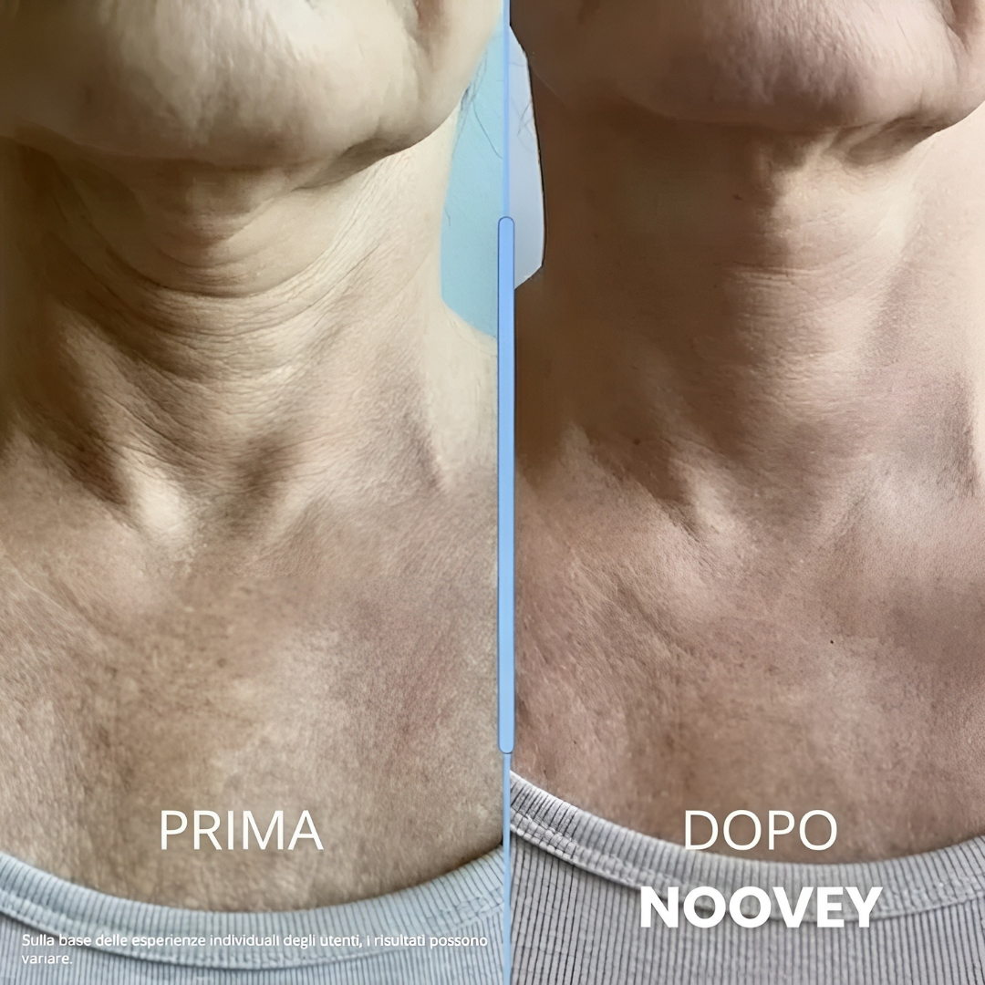 Key Lift™ - Crème Liftante au Collagène pour Cou et Décolleté