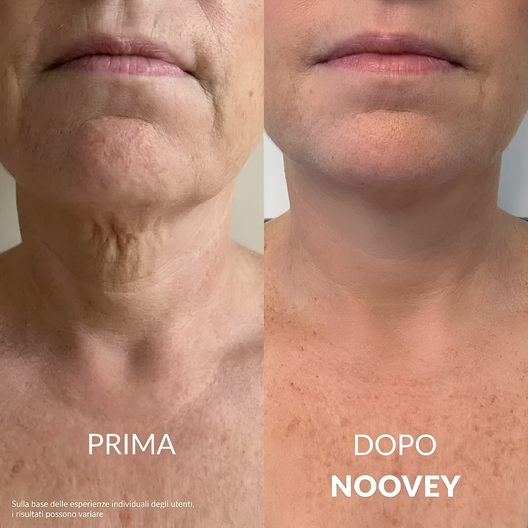 Key Lift™ - Crème Liftante au Collagène pour Cou et Décolleté