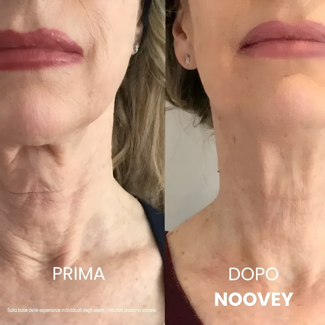 Key Lift™ - Crème Liftante au Collagène pour Cou et Décolleté