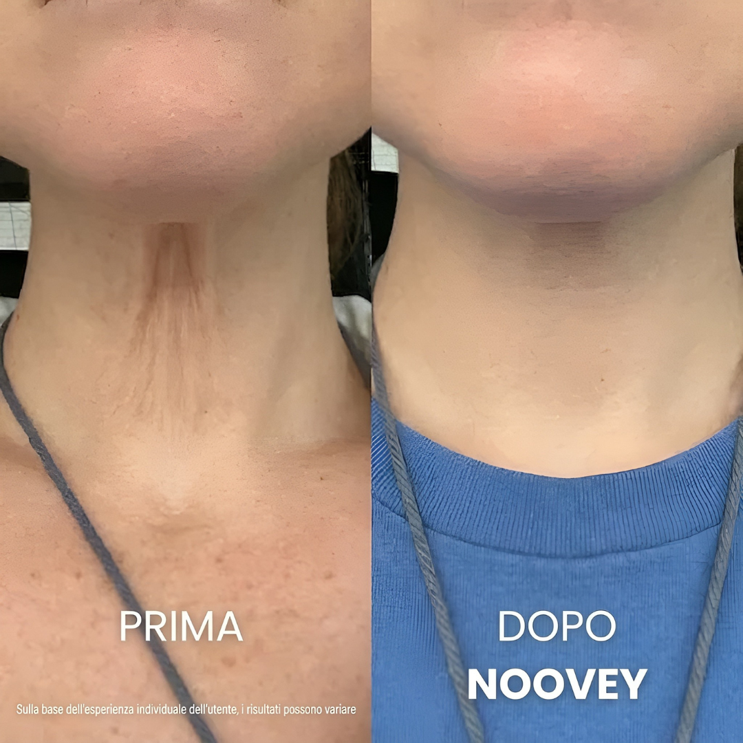 Key Lift™ - Crème Liftante au Collagène pour Cou et Décolleté