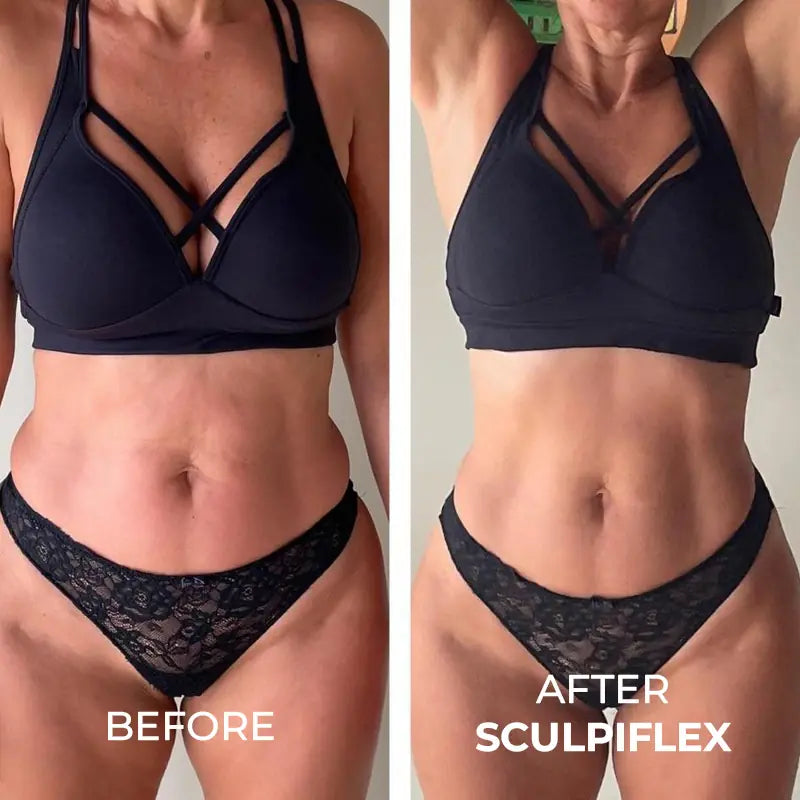 SculpiFlex™ - Body Sculpting Device