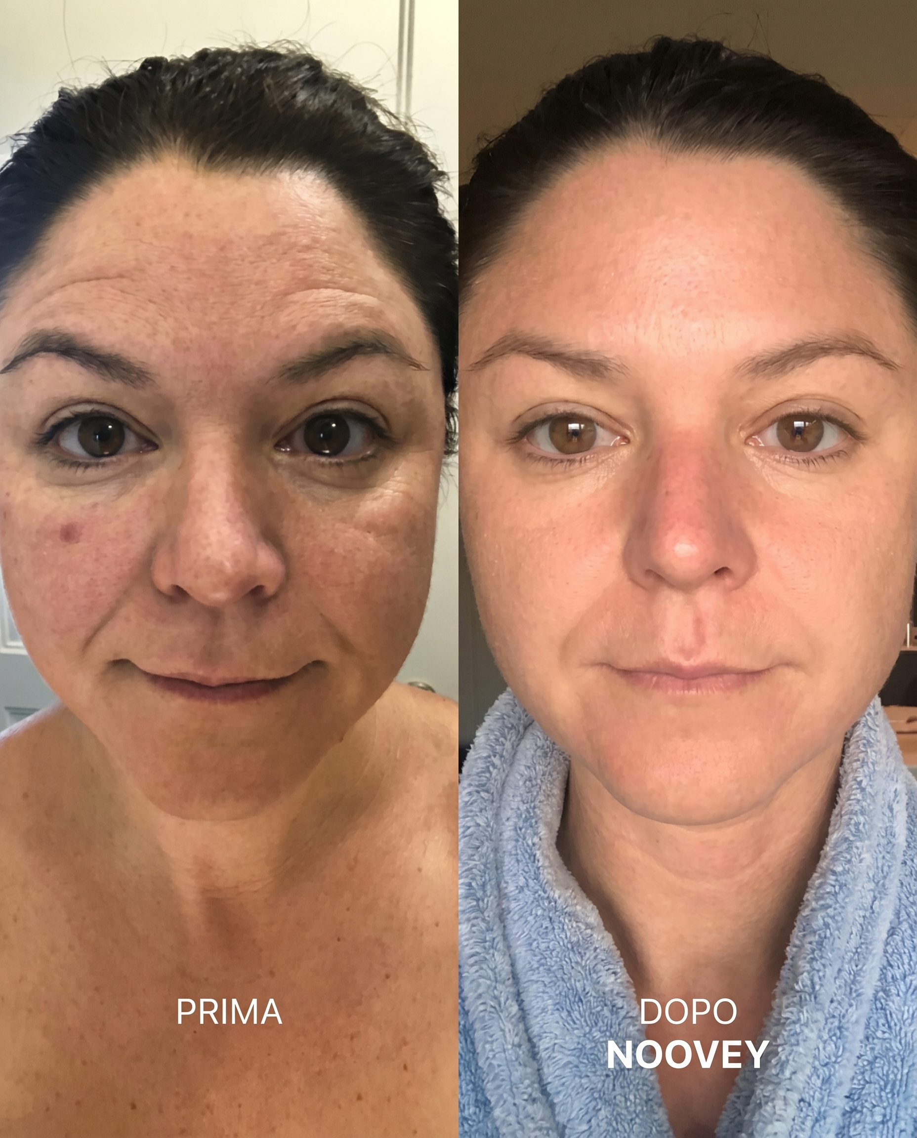 Kollagen-Lifting-Balsam-Stick - Formel mit NAD+ & PDRN