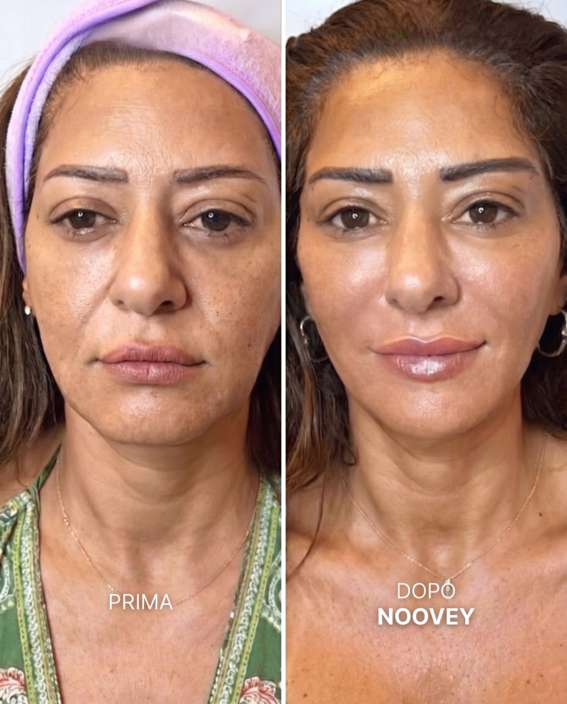 Kollagen-Lifting-Balsam-Stick - Formel mit NAD+ & PDRN